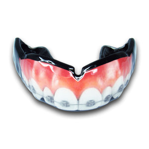 <span>Teeth w/ Braces</span> Mouthguard | Mouthpiece Guy