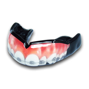 <span>Teeth w/ Braces</span> Mouthguard | Mouthpiece Guy