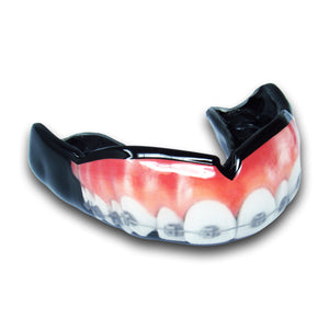 <span>Teeth w/ Braces</span> Mouthguard | Mouthpiece Guy