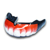 real teeth mouthguards by mouthpiece guy - side 2 view